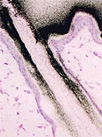 Micro autoradiography skin section