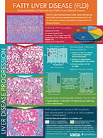 Biobank infographic