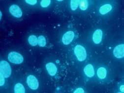 DNA Straining