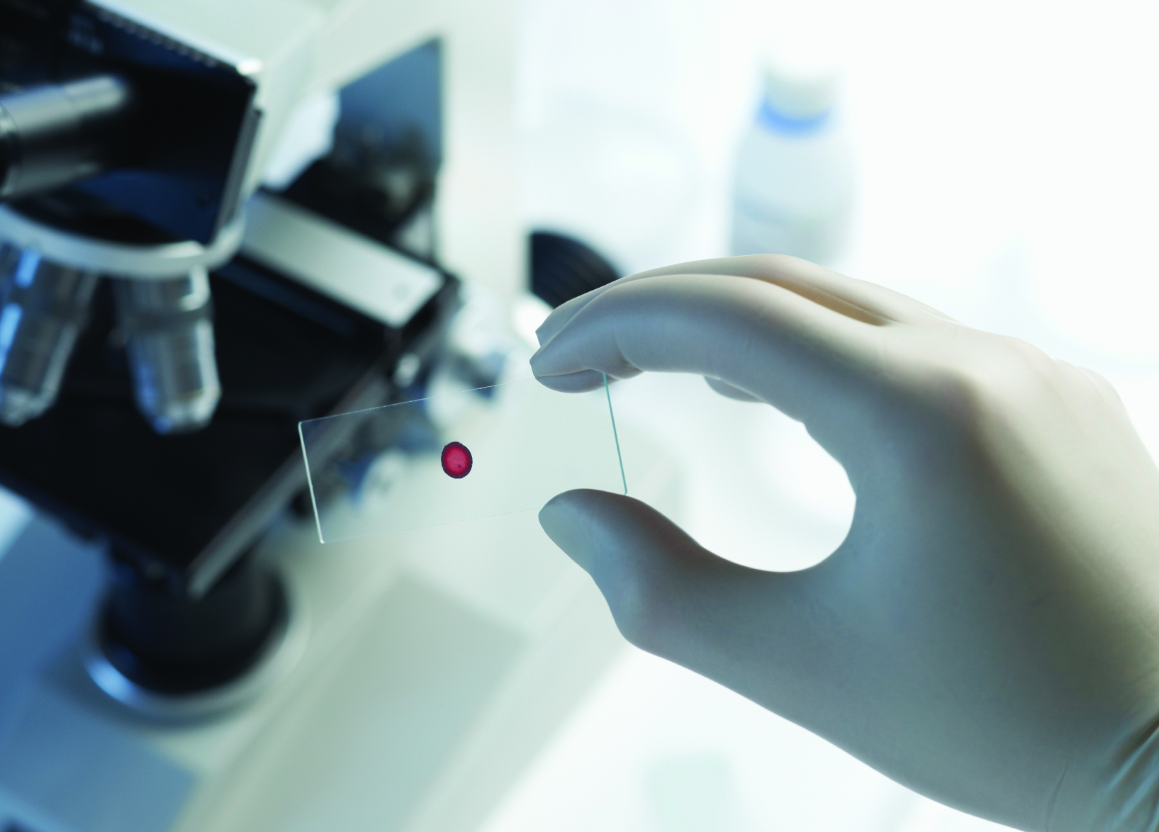 Scientist holding blood sample slide