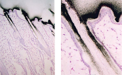 Microautoradiography (mARG) skin section can show distribution in specific parts of a tissue or organ