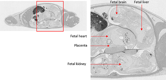 Placental transfer studies can inform how a drug candidate may pass from mother to fetus during pregnancy