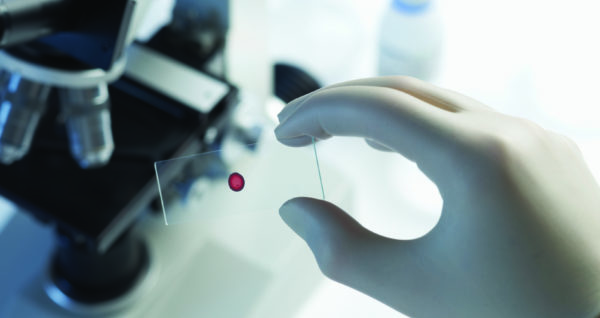 Scientist placing blood sample under microscope in laboratory selective focus