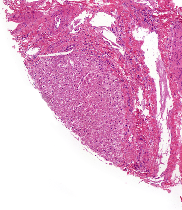 Rat Liver Microsomes, Tritosomes, S9 & Cytosol