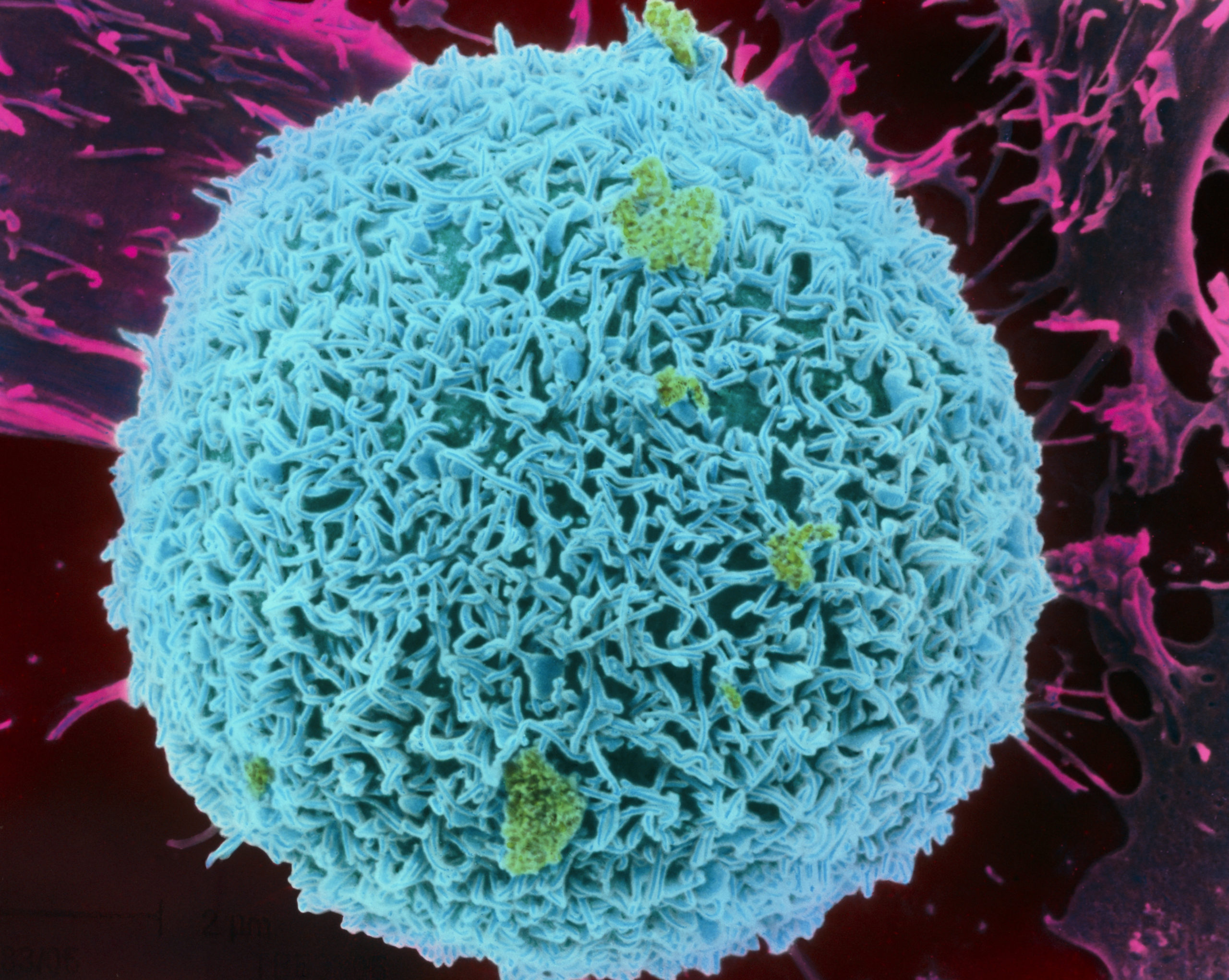 Coloured SEM of a liver cell (hepatocyte)