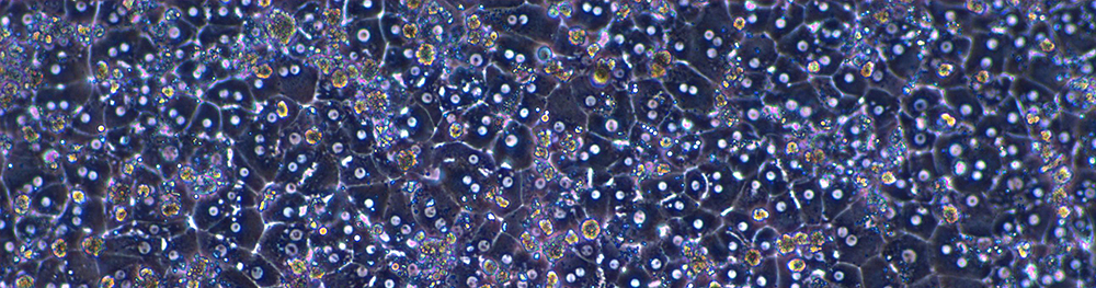 Plated human hepatocytes